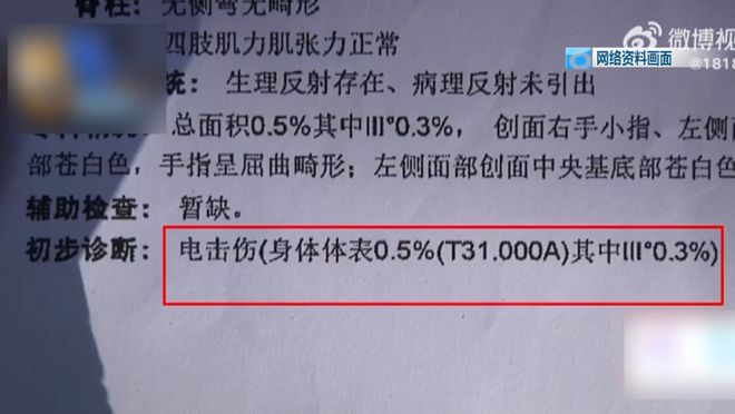 ！5岁儿童爬空调外机瞬间晕厥！凯时尊龙最新网站肌腱都打断了(图4)